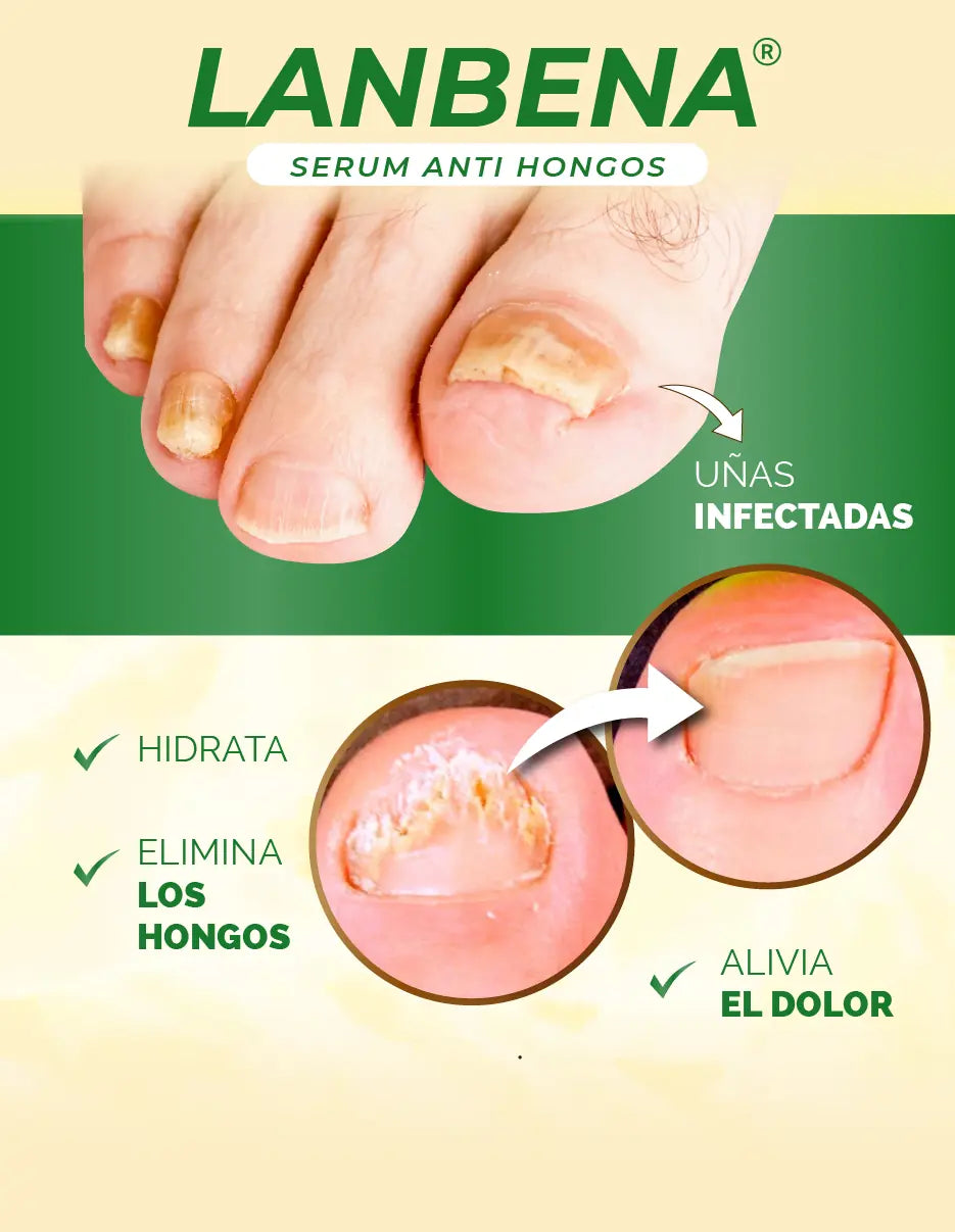 REMOVEDOR DE HONGOS LANBENA [PV1-META-CLICKPLUSMX]