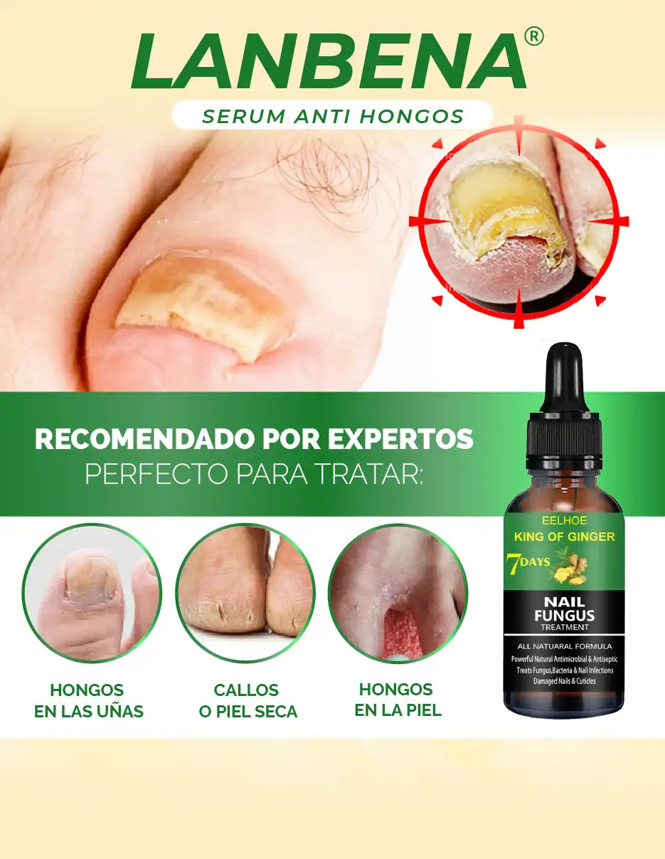 REMOVEDOR DE HONGOS LANBENA [PV1-META-CLICKPLUSMX]
